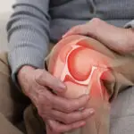 What Is Arthritis_ A Clear Guide to Osteoarthritis (Revised)