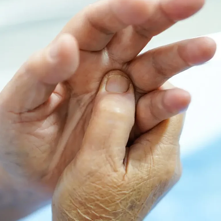 Thumb Joint Osteoarthritis