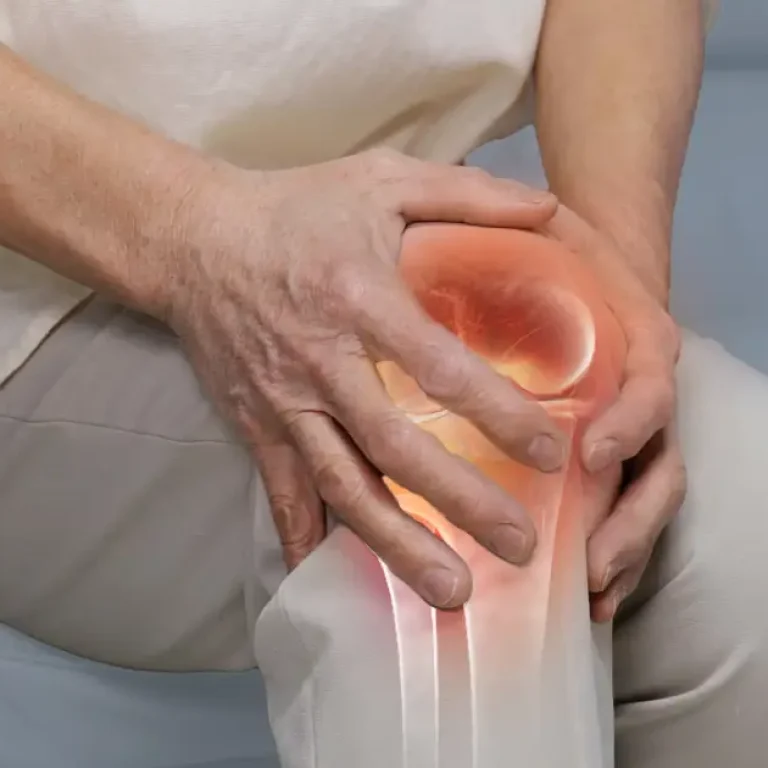 Key Signs of Knee Osteoarthritis and What You Can Do About It #2